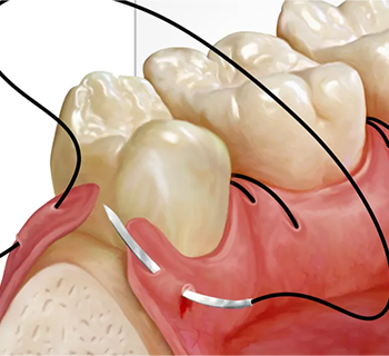 Dental Checkup Clinic in Chembur