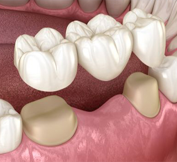 Best Tooth Clinic in Chembur