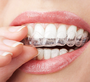 Best Dentist for Tooth Pain in Chembur